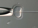 RC oocyte zona pellucida.jpg