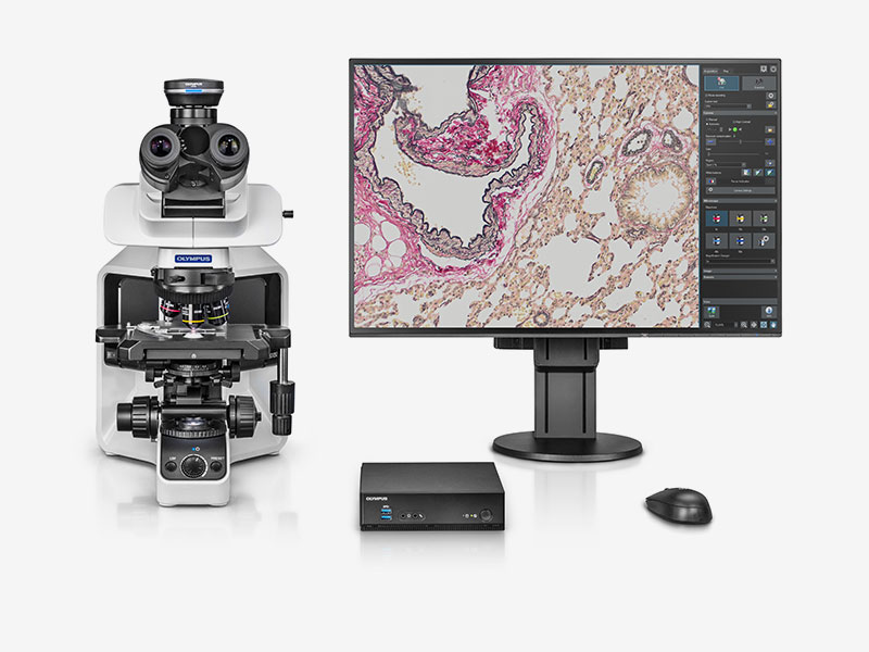 Microscope camera, Olympus DP23 w. DP2-AOU Stand-Alone Unit, 6.4 MPx, 1/1.8", Color